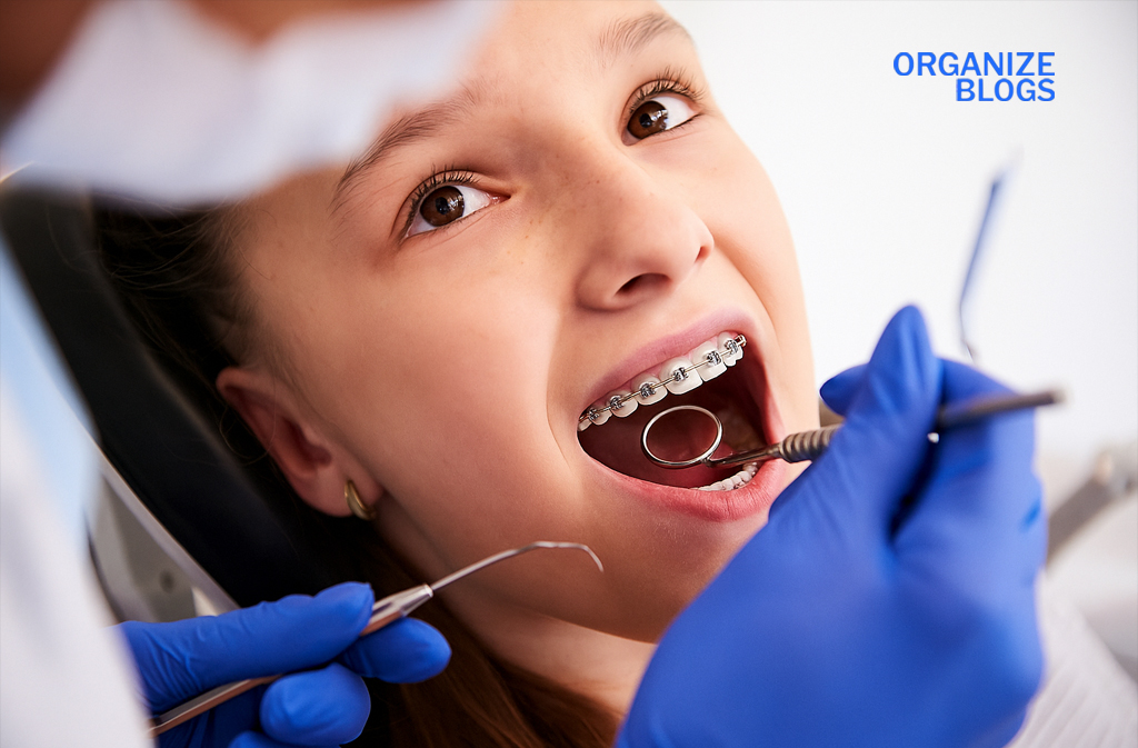 ceramic braces ceramic braces
